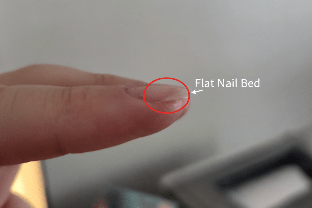 I Tested It: Say Goodbye to Flat Nail Lifting & Pain ✨ - MOONLEE
